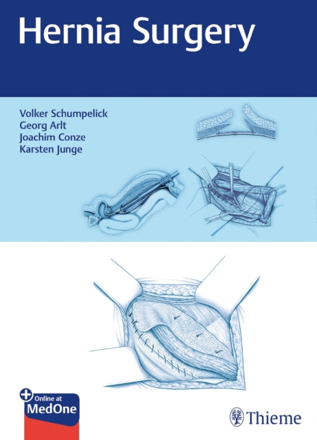 Book cover of: Hernia Surgery. By: Volker Schumpelick