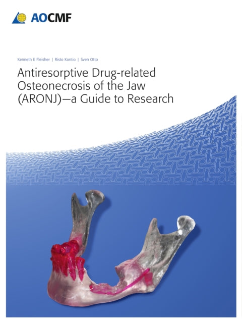 Book cover of: Antiresorptive Drug-Related Osteonecrosis of the Jaw (ARONJ) - a Guide to Research. By: Kenneth Fleisher