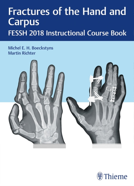 Book cover of: Fractures of the Hand and Carpus. By: Michel E. H. Boeckstyns