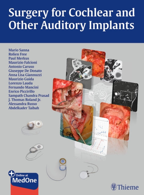 Book cover of: Surgery for Cochlear and Other Auditory Implants. By: Mario Sanna