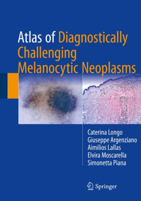 Book cover of: Atlas of Diagnostically Challenging Melanocytic Neoplasms. By: Caterina Longo