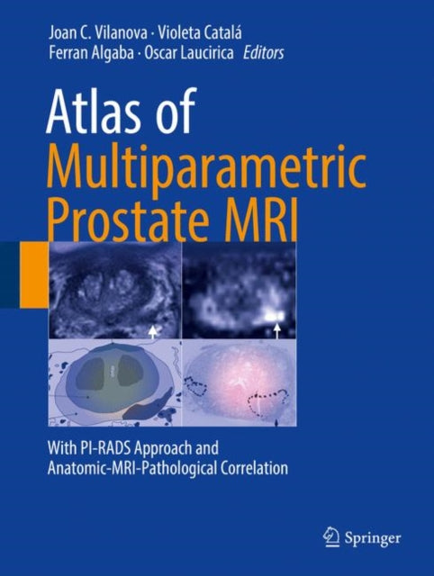 Book cover of: Atlas of Multiparametric Prostate MRI. By: Joan C. Vilanova