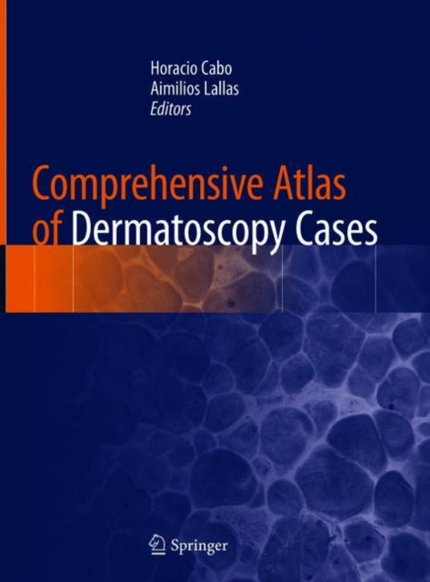Book cover of: Comprehensive Atlas of Dermatoscopy Cases