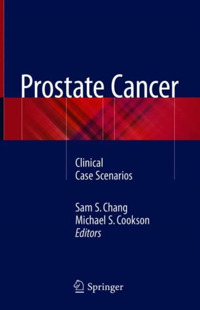 Book cover of: Prostate Cancer. By: Sam S. Chang