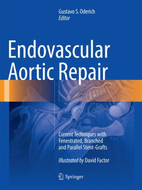 Book cover of: Endovascular Aortic Repair. By: Gustavo S. Oderich