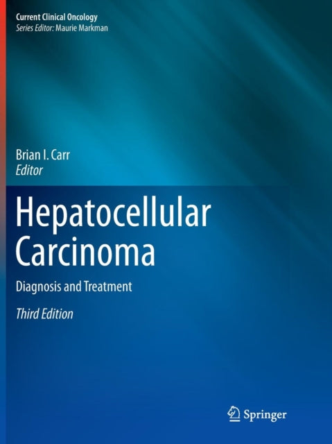 Book cover of: Hepatocellular Carcinoma. By: Brian I. Carr