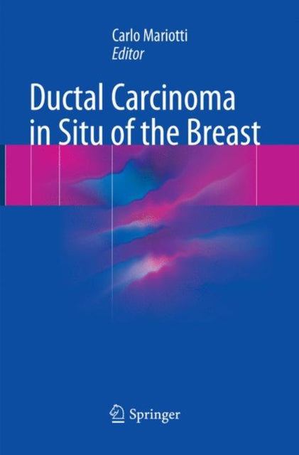 Book cover of: Ductal Carcinoma in Situ of the Breast. By: Carlo Mariotti