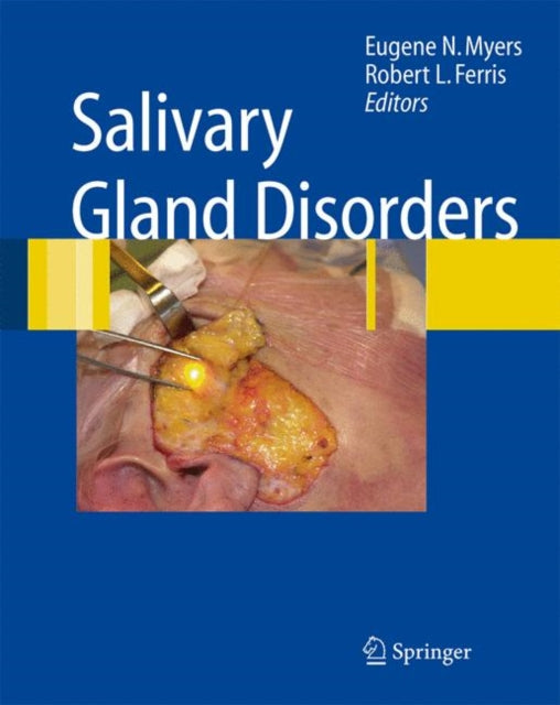 Book cover of: Salivary Gland Disorders