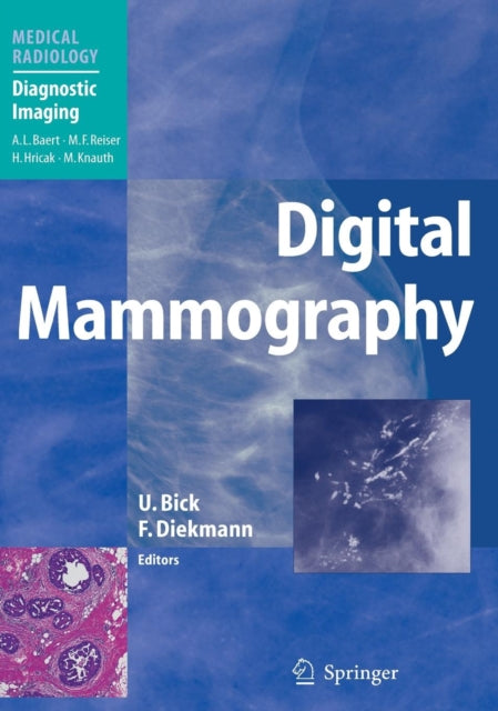 Book cover of: Digital Mammography