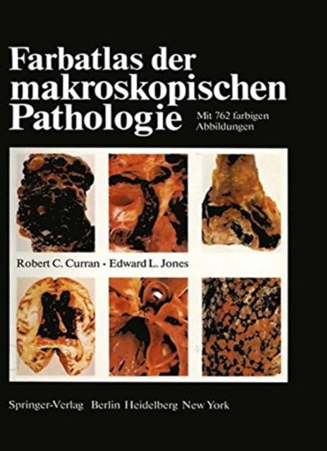 Book cover of: Farbatlas der makroskopischen Pathologie. By: R. C. Curran