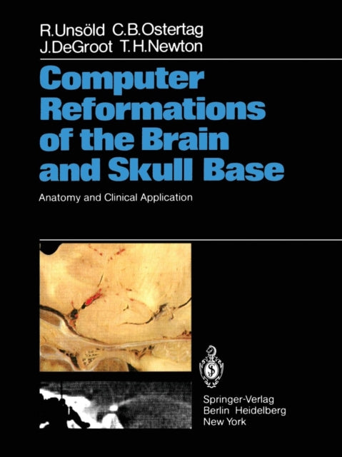 Book cover of: Computer Reformations of the Brain and Skull Base. By: R. Unsöld