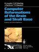 Book cover of: Computer Reformations of the Brain and Skull Base. By: R. Unsöld