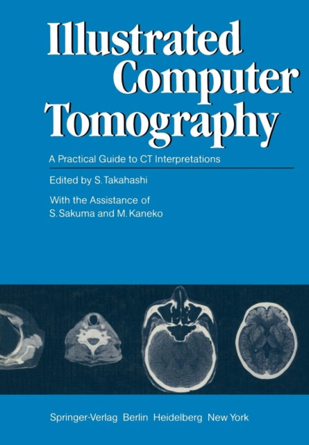 Book cover of: Illustrated Computer Tomography. By: Shinji Takahashi
