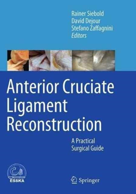 Book cover of: Anterior Cruciate Ligament Reconstruction. By: Rainer Siebold