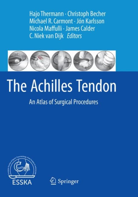 Book cover of: Achilles Tendon. By: Hajo Thermann