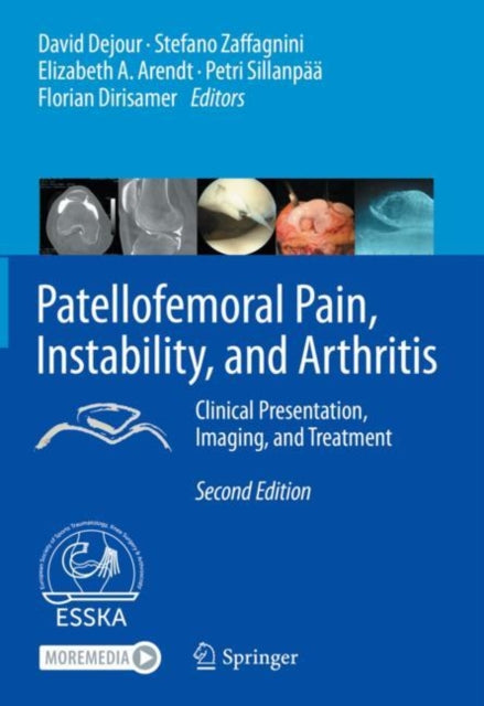 Book cover of: Patellofemoral Pain, Instability, and Arthritis. By: David Dejour