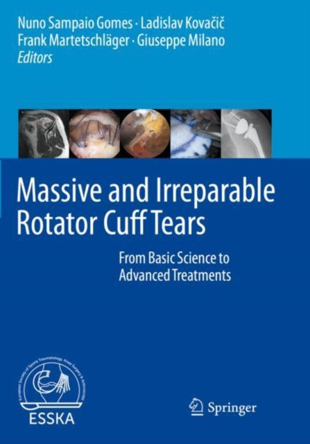 Book cover of: Massive and Irreparable Rotator Cuff Tears. By: Nuno Sampaio Gomes