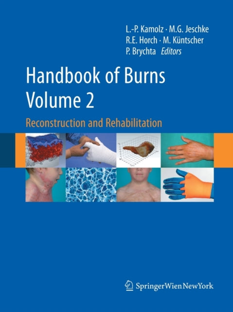 Book cover of: Handbook of Burns Volume 2. By: Lars-Peter Kamolz