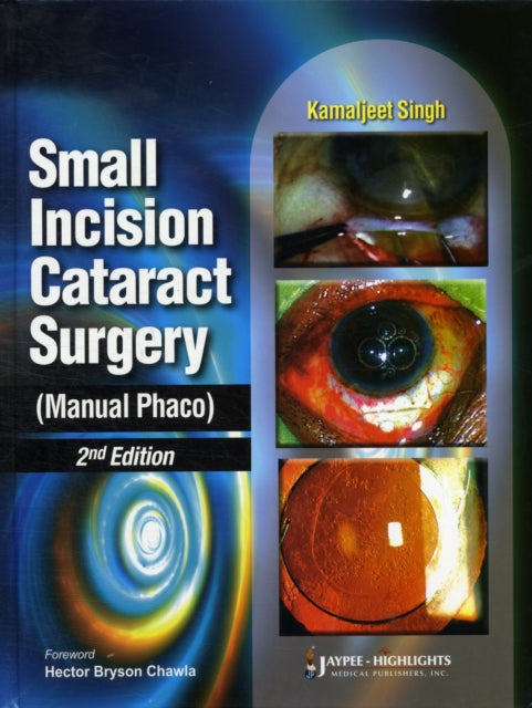 Book cover of: Small Incision Cataract Surgery (Manual Phaco)