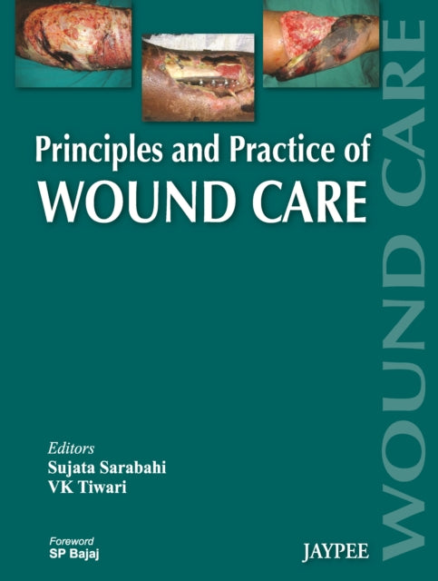 Book cover of: Principles and Practice Of Wound Care. By: Tiwari Sarabahi