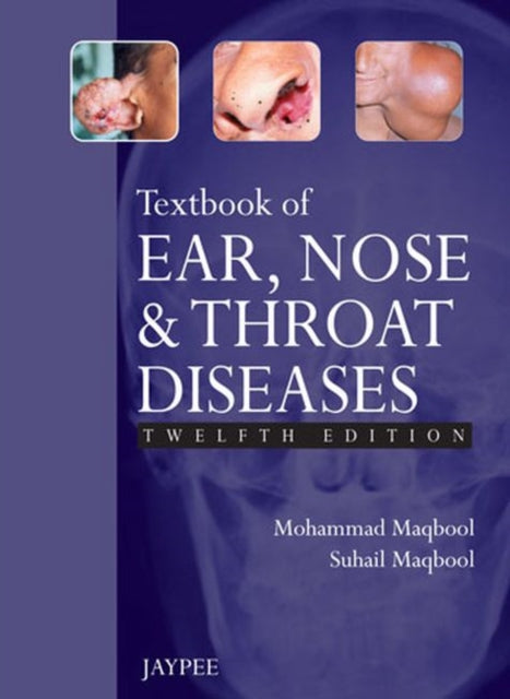 Book cover of: Textbook of Ear, Nose and Throat Diseases. By: Mohammad Maqbool