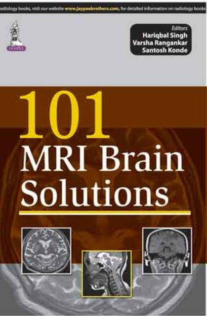 Book cover of: 101 MRI Brain Solutions. By: Hariqbal Singh