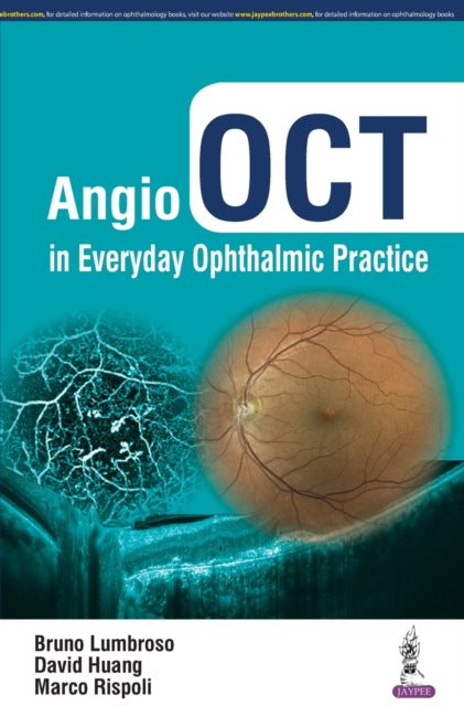 Book cover of: Angio OCT in Everyday Ophthalmic Practice. By: Bruno Lumbroso
