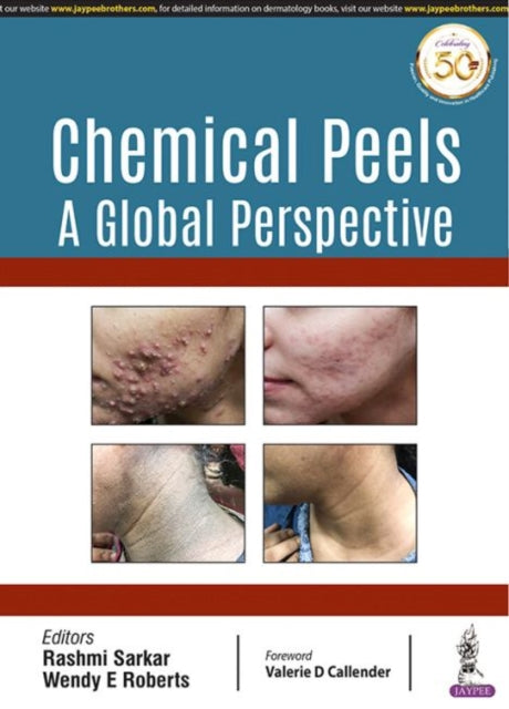 Book cover of: Chemical Peels: A Global Perspective. By: Ishad Aggarwal