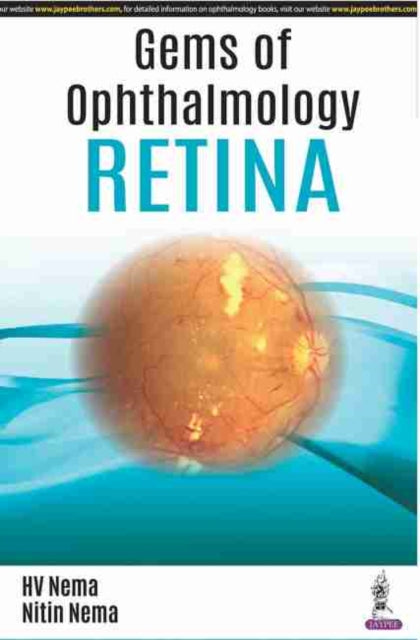 Book cover of: Gems of Ophthalmology: Retina. By: H. V. Nema