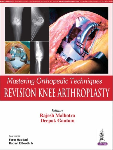 Book cover of: Mastering Orthopedic Techniques: Revision Knee Arthroplasty. By: Rajesh Malhotra