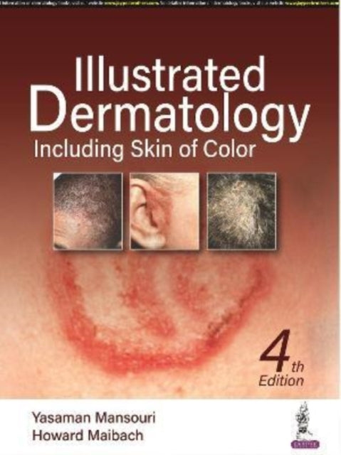 Book cover of: Illustrated Dermatology. By: Yasaman Mansouri
