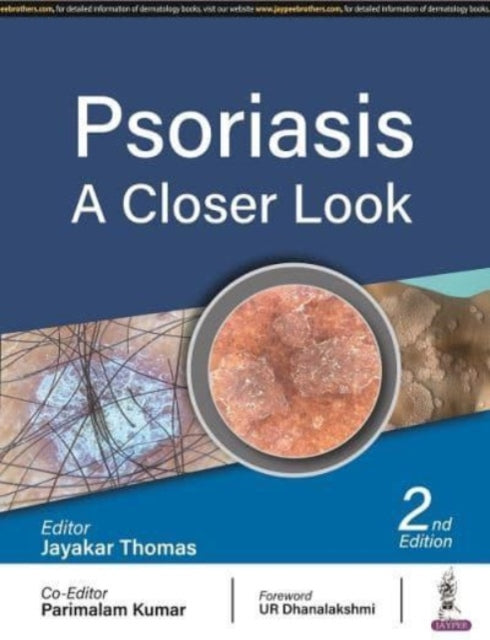 Book cover of: Psoriasis. By: Jayakar Thomas
