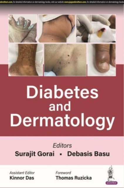 Book cover of: Diabetes and Dermatology. By: Basu GORAI