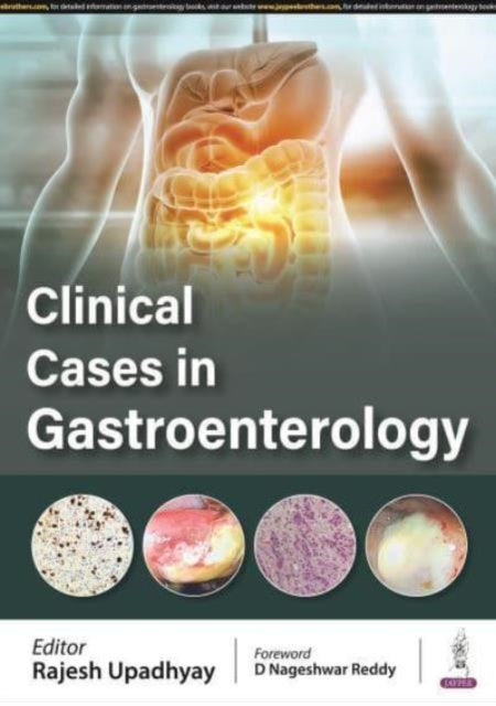 Book cover of: Clinical Cases in Gastroenterology. By: Rajesh Upadhyay