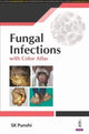 Book cover of: Fungal Infections. By: PUNSHI