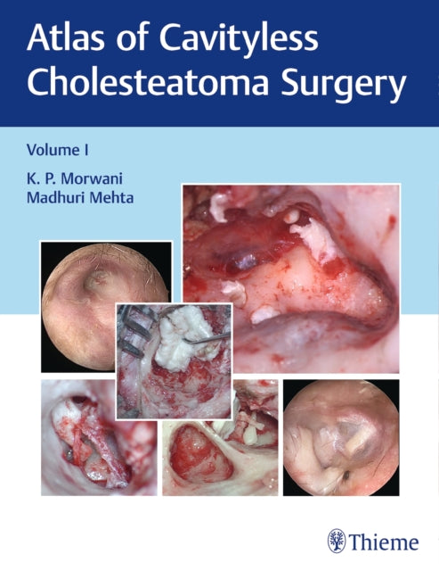 Book cover of: Atlas of Cavityless Cholesteatoma Surgery, Vol 1. By: K. Morwani