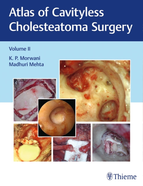 Book cover of: Atlas of Cavityless Cholesteatoma Surgery, Vol 2. By: K. Morwani