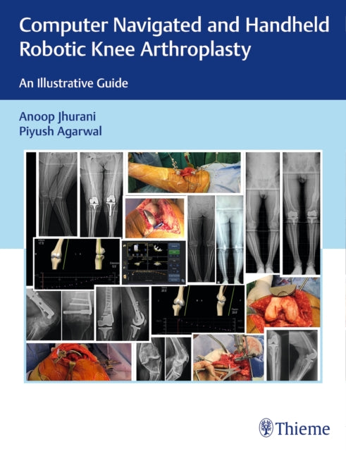 Book cover of: Computer Navigated and Handheld Robotic Knee Arthroplasty. By: Anoop Jhurani