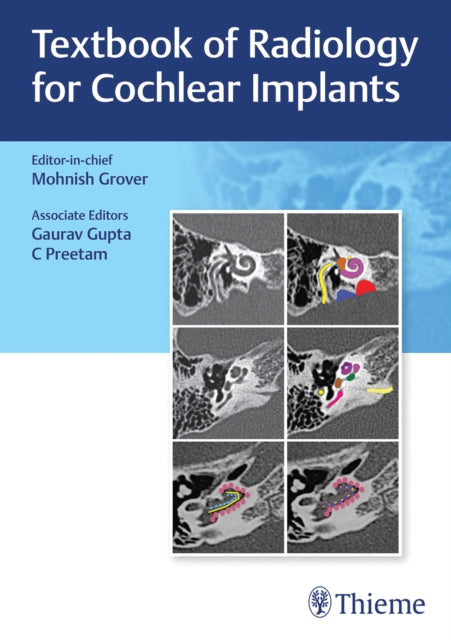 Book cover of: Textbook of Radiology for Cochlear Implants. By: Mohnish Grover
