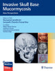 Book cover of: Invasive Skull Base Mucormycosis. By: Narayanan Janakiram