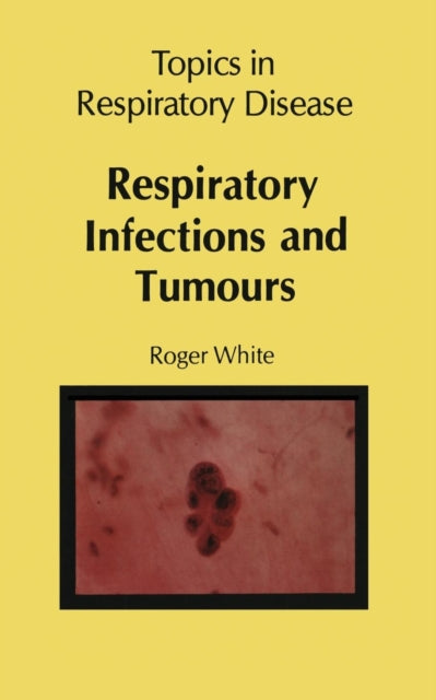 Book cover of: Respiratory Infections and Tumours. By: R. White