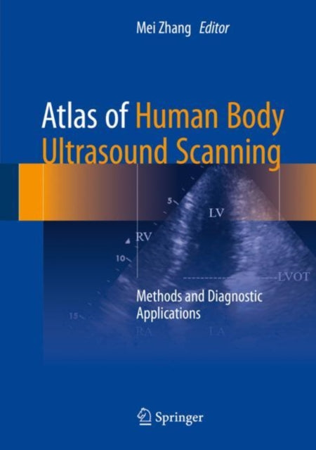 Book cover of: Atlas of Human Body Ultrasound Scanning. By: Mei Zhang