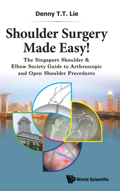 Book cover of: Shoulder Surgery Made Easy!: The Singapore Shoulder & Elbow Society Guide To Arthroscopic And Open Shoulder Procedures. By: Denny T. T. Lie