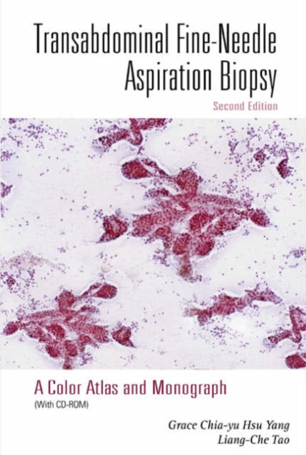 Book cover of: Transabdominal Fine-needle Aspiration Biopsy (2nd Edition): A Color Atlas And Monograph (With Cd-rom). By: M.D. Grace C H Yang
