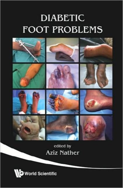 Book cover of: Diabetic Foot Problems