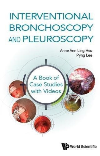 Book cover of: Interventional Bronchoscopy And Pleuroscopy: A Book Of Case Studies With Videos. By: Anne Ann Ling Hsu