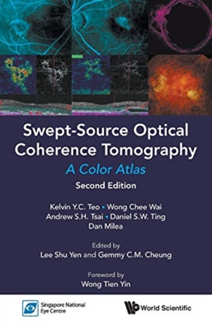 Book cover of: Swept-source Optical Coherence Tomography: A Color Atlas. By: Kelvin Y. C. Teo