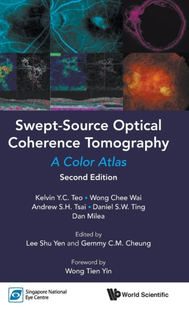 Book cover of: Swept-Source Optical Coherence Tomography. By: Kelvin Y. C. Teo